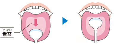 舌ケアの方法